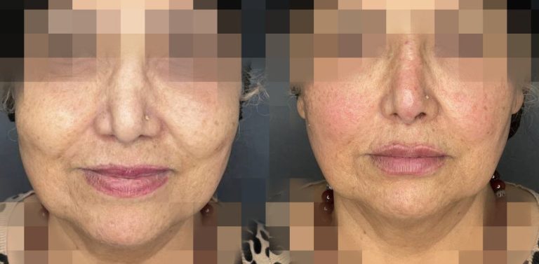 IMG_20240710_173742_243