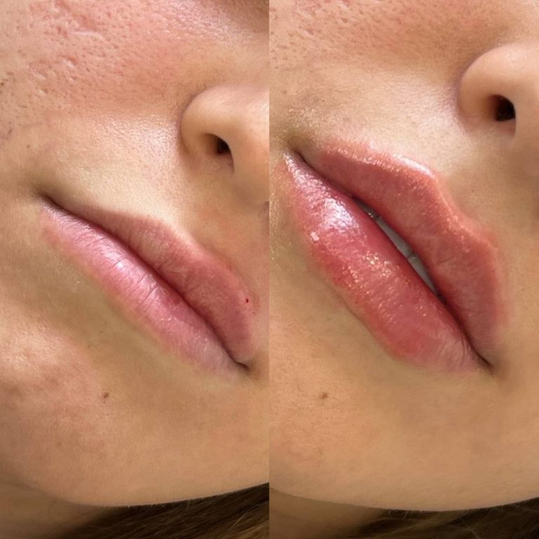 IMG_20240710_173745_738