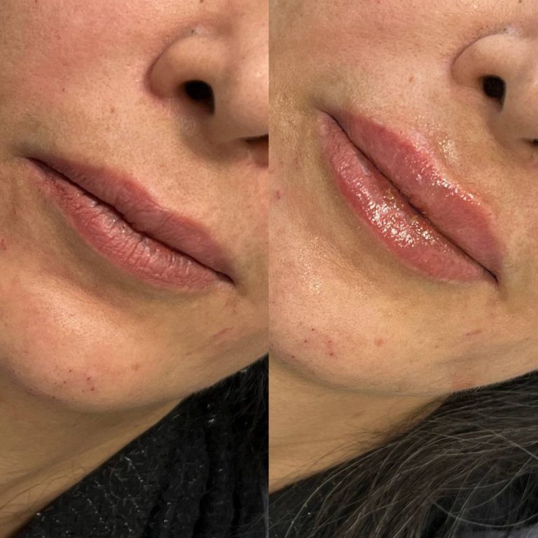 IMG_20240710_173746_608