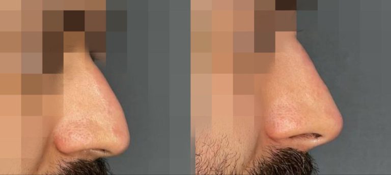 IMG_20240710_173751_466