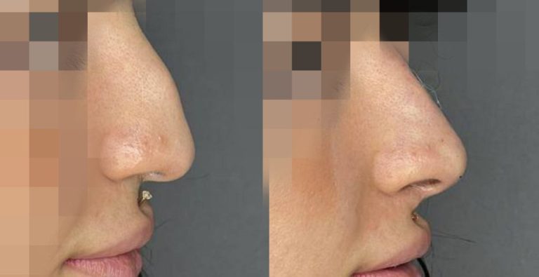 IMG_20240710_173751_496