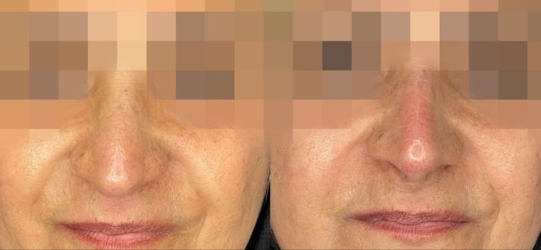 IMG_20240710_173752_440